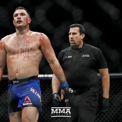 Gian Villante is a bloody mess during his fight at UFC on FOX 25.