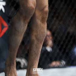Gilbert Melendez’s legs took some damage at UFC 215.