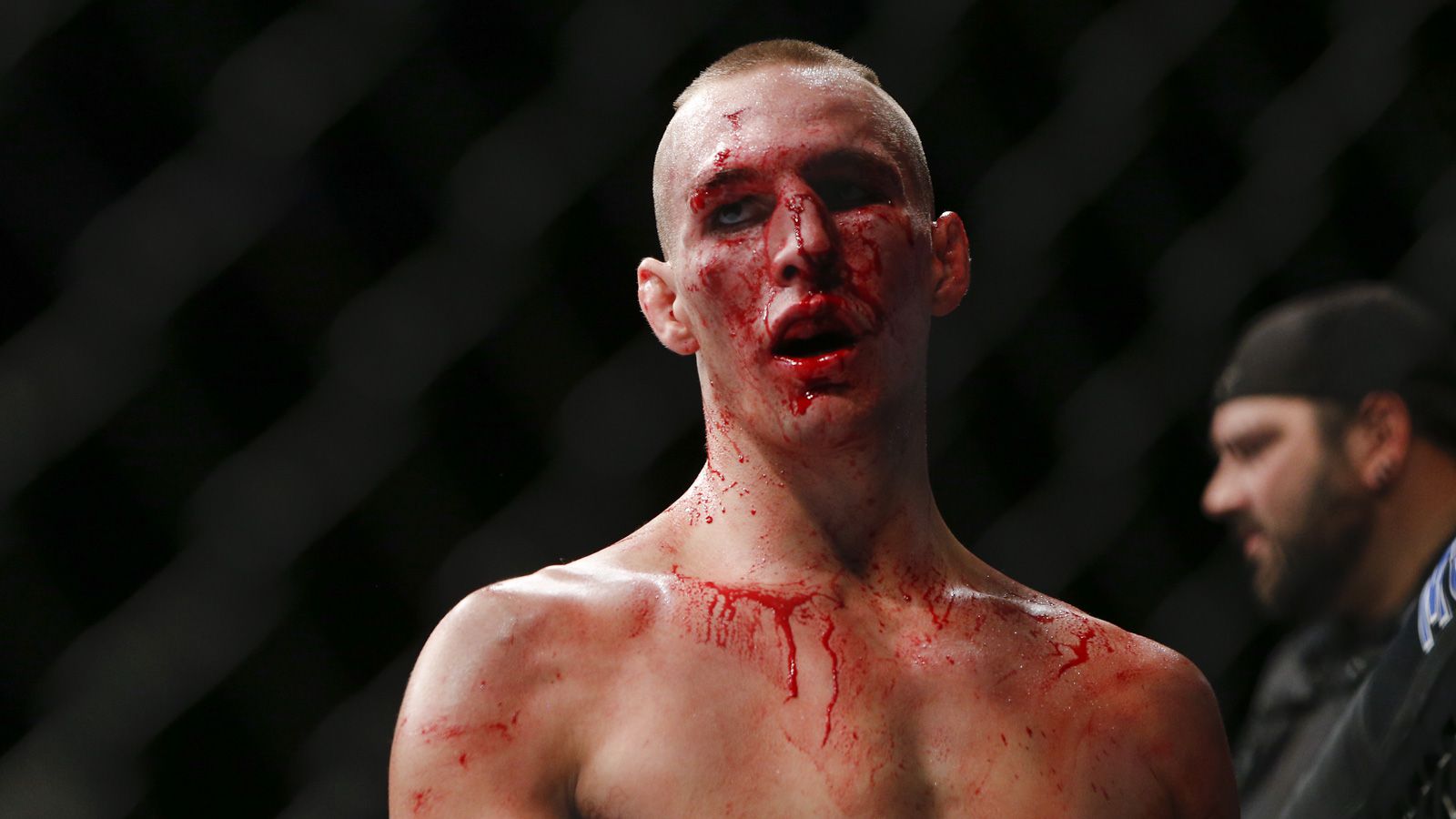 Dana White: Rory MacDonald ‘didn’t know what year it was’ after UFC 189